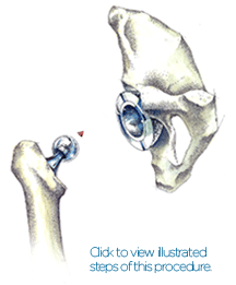 Jeffrey McLaughlin, MD